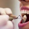 Art of Periodontics