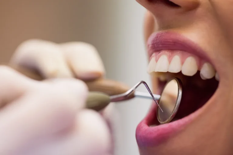 Art of Periodontics