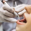 Nobel Dental Art