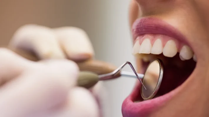 Art of Periodontics