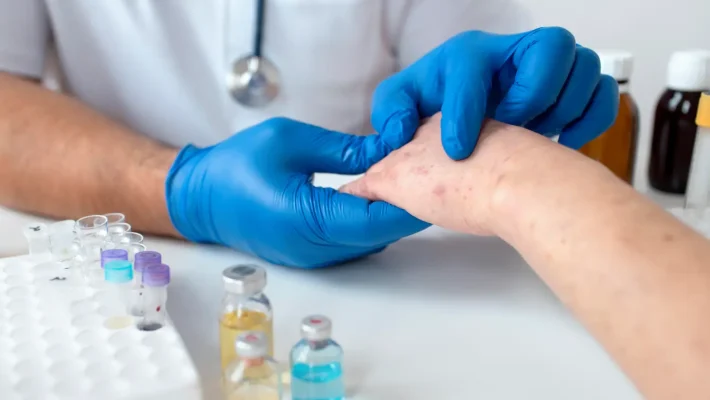 Parviz Jahangir-Iranian Allergist